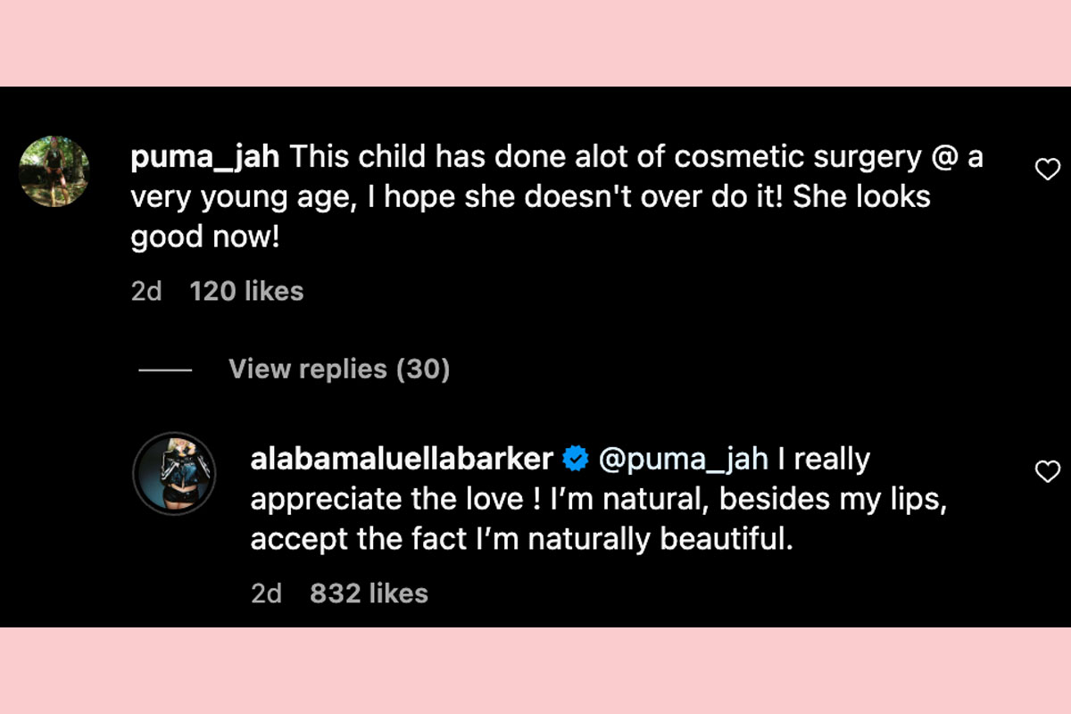 Alabama Barker Responds To Plastic Surgery Claims!